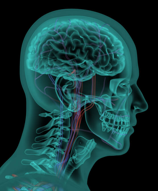Рентгеновский снимок головы и шеи с сосудами